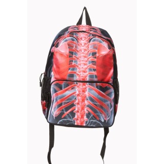 Sac  dos cage thoracique rouge rayons X - Banned